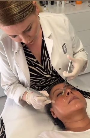 Mesoterapia con Vitaminas